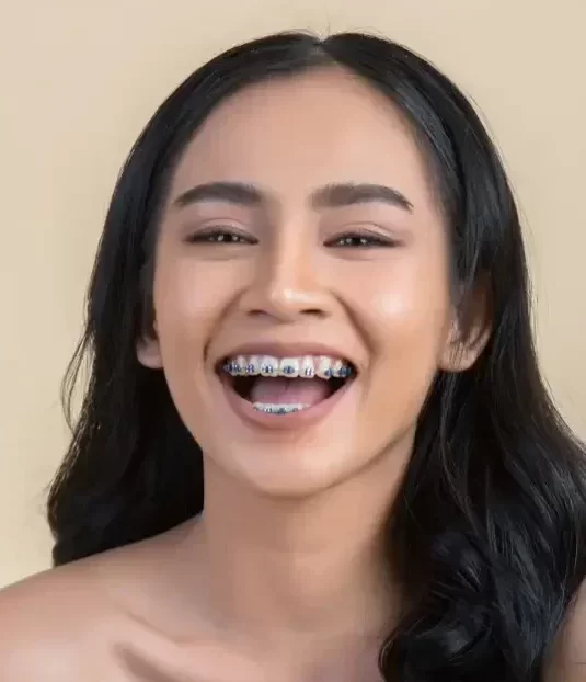 Ortodoncia Niños, Jóvenes y Adultos en San Luis Potosi